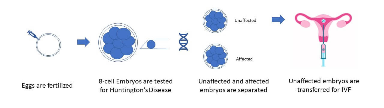 Pre-implantation Genetic Diagnosis process