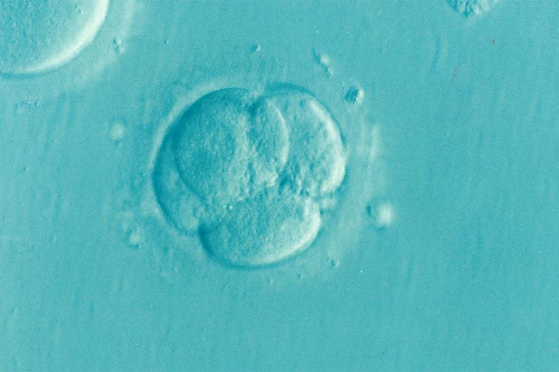 PGD-IVF